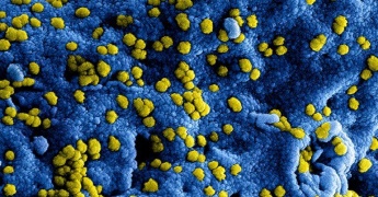 Coronavirus: concrete maatregelen afbeelding